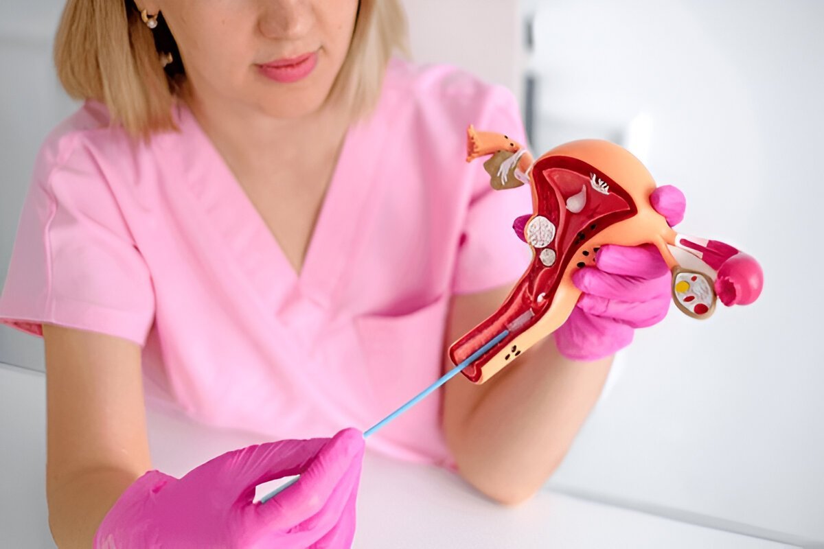 Міома матки та вагітність: що потрібно знати – рекомендації Medical Plaza Міома матки та вагітність: що потрібно знати – рекомендації Medical Plaza