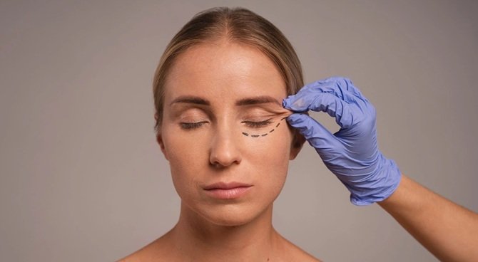 блефаропластика