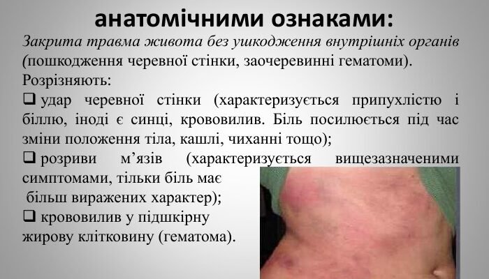 Удар в живіт: наслідки та ризики для вашого здоров’я