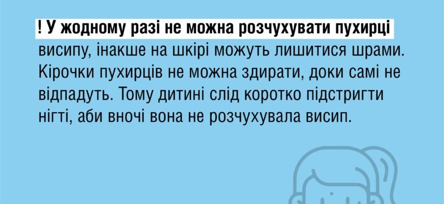 Чи можна захворіти вітрянкою вдруге: міф чи реальність?