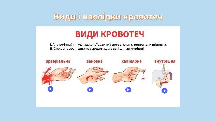 Види і наслідки кровотеч: розглядаємо основні категорії та ризики
