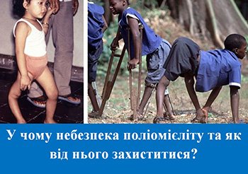 Поліомієліт: наслідки, які варто знати для здоров’я вашої дитини