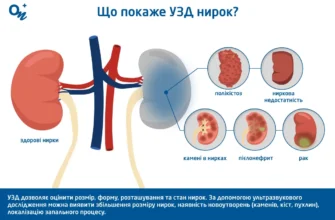 Чи можна їсти перед УЗД нирок: важливі поради для пацієнтів