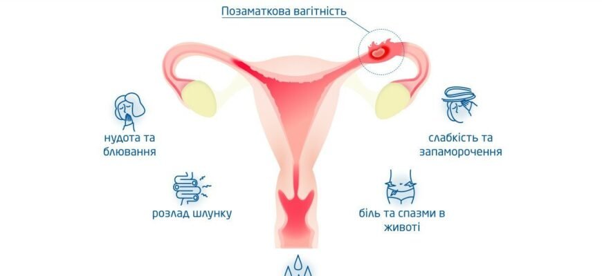 Позаматкова вагітність: чи можливо народити без ризиків?