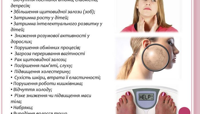 Наслідки йододефіциту: вплив на здоров’я і вирішення проблеми Наслідки йододефіциту: вплив на здоров’я і вирішення проблеми