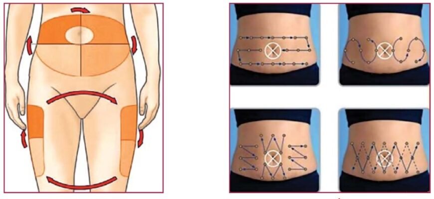 Чи можна перестати колоти інсулін: шляхи та ризики для здоров’я