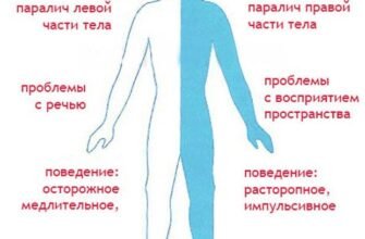 Наслідки ішемічного інсульту: розуміння, профілактика та відновлення