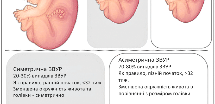 Затримка розвитку плода: наслідки та можливі рішення для батьків Затримка розвитку плода: наслідки та можливі рішення для батьків