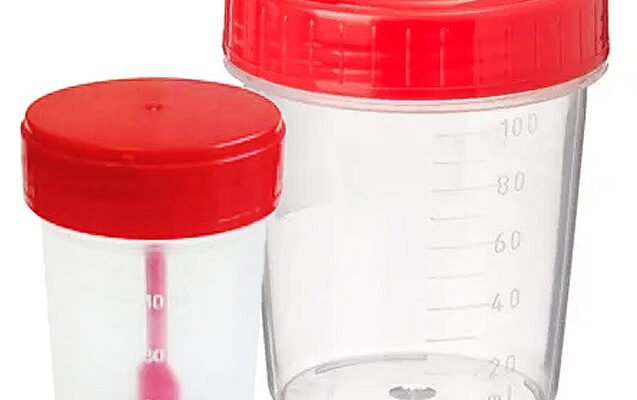 Чи можна здавати вечірній кал: розвінчання міфів та поради експертів Чи можна здавати вечірній кал: розвінчання міфів та поради експертів