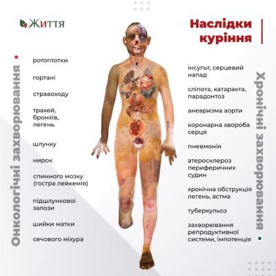 Наслідки куріння: Який вплив на здоров’я і як уникнути ризиків?