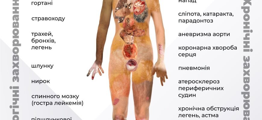 Наслідки куріння: Який вплив на здоров’я і як уникнути ризиків?