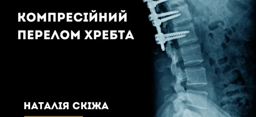 Компресійний перелом хребта: наслідки та їх вплив на здоров’я Компресійний перелом хребта: наслідки та їх вплив на здоров’я