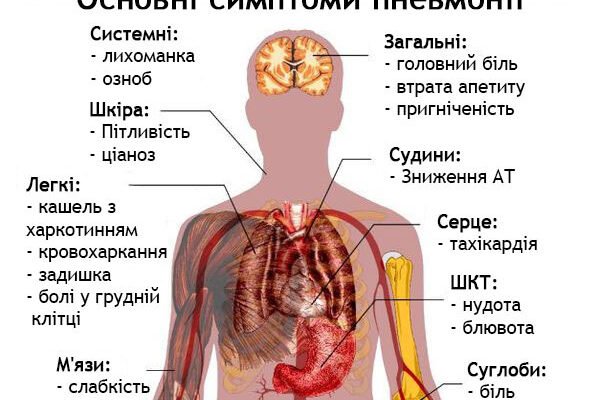 Чи можна гуляти при пневмонії: важливі рекомендації для здоров’я