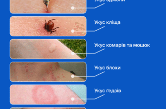 Укус оси: наслідки, перша допомога та як уникнути алергії