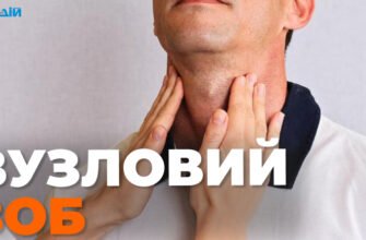 Чи можна вилікувати вузловий зоб: сучасні методи та рекомендації