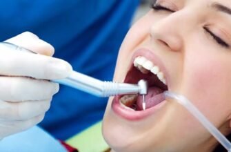 NewDental – якісні матеріали для пломбування зубів та професійної терапії
