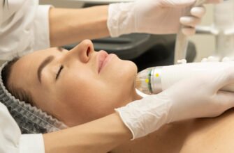 Мікрогольчастий RF-ліфтинг: що це, кому підходить і чому Vivace та Morpheus8 — серед лідерів процедур Мікрогольчастий RF-ліфтинг: що це, кому підходить і чому Vivace та Morpheus8 — серед лідерів процедур