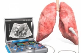 Обстеження легень за допомогою УЗД: важливість та переваги Обстеження легень за допомогою УЗД: важливість та переваги