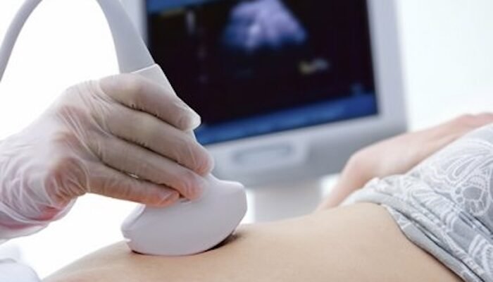 Что такое УЗИ и его значение в современной медицине